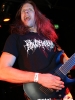 Stillbirth